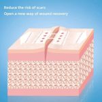 Sutura Adhesiva Reemplazo Puntos Para Corte Profundo 1un - Imagen 8